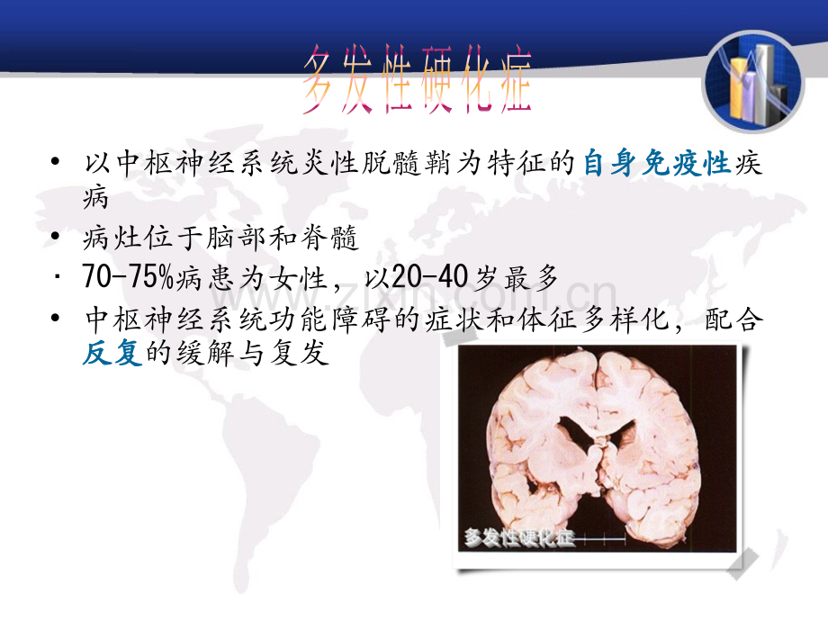 多发性硬化症.ppt_第2页