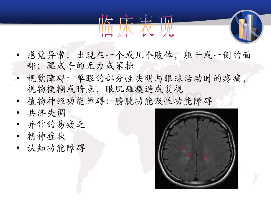 多发性硬化症.ppt_第3页