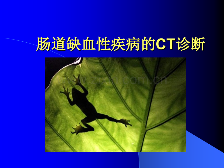 肠道缺血性疾病的CT诊断.ppt_第1页