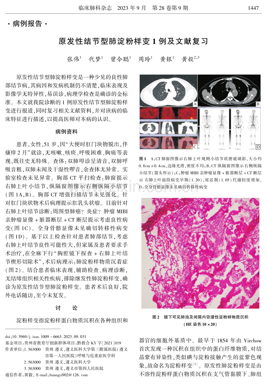 原发性结节型肺淀粉样变1例及文献复习.pdf_第1页