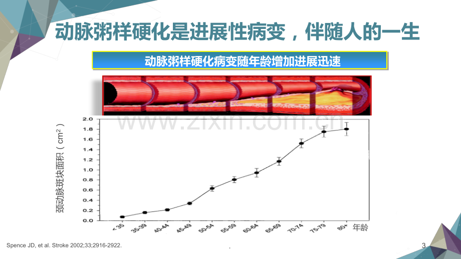 动脉粥样硬化的发生机制PPT课件.ppt_第3页