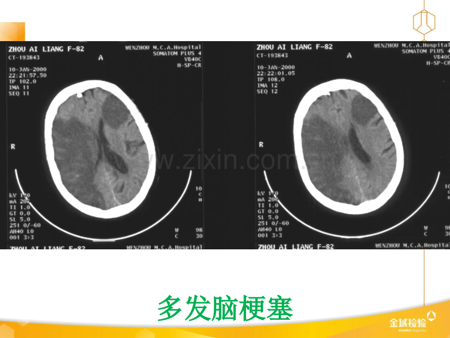 部分常见疾病C影像ppt课件.ppt_第2页