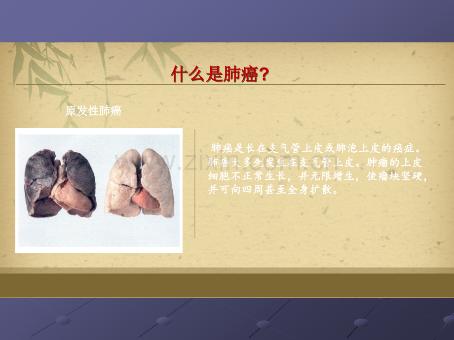 肺癌的护理常规ppt课件.ppt_第3页