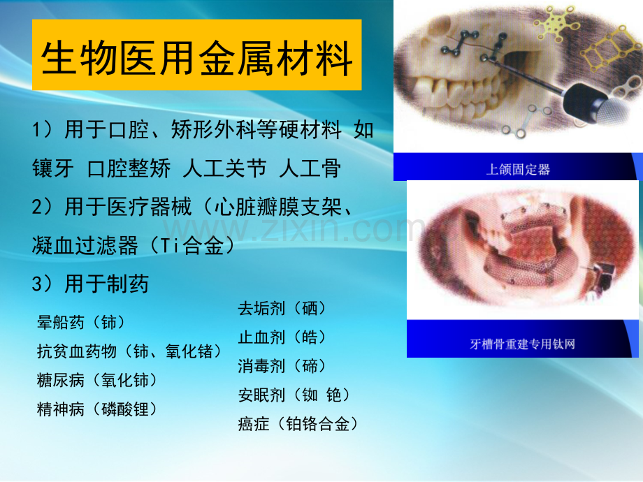 医用金属材料.pptx_第3页