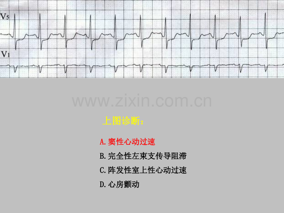 住院医师心电图规陪出科考试辅助检查ppt课件.ppt_第1页