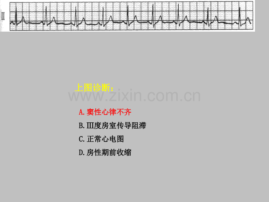 住院医师心电图规陪出科考试辅助检查ppt课件.ppt_第2页