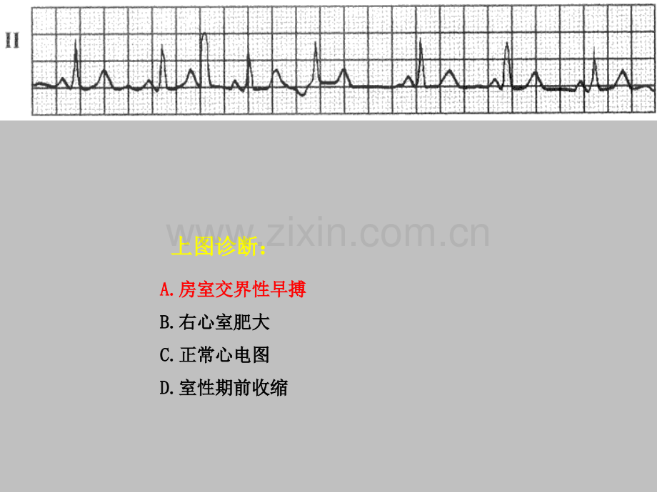 住院医师心电图规陪出科考试辅助检查ppt课件.ppt_第3页