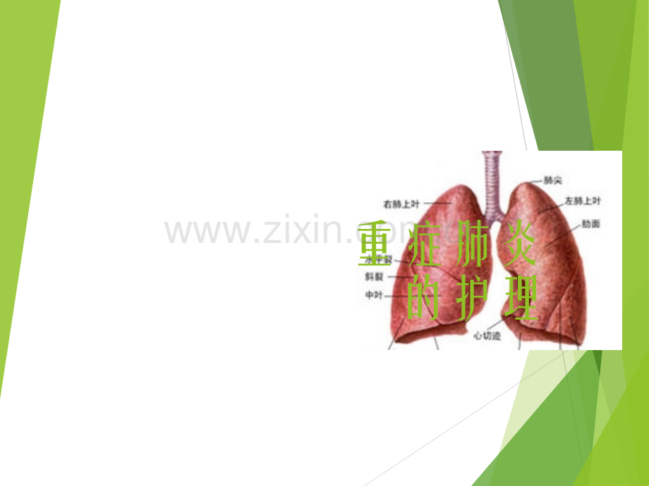 重症肺炎的护理.ppt_第1页