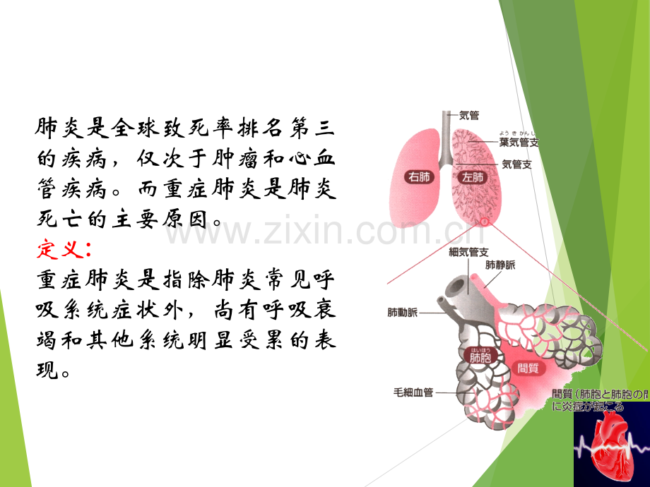 重症肺炎的护理.ppt_第2页