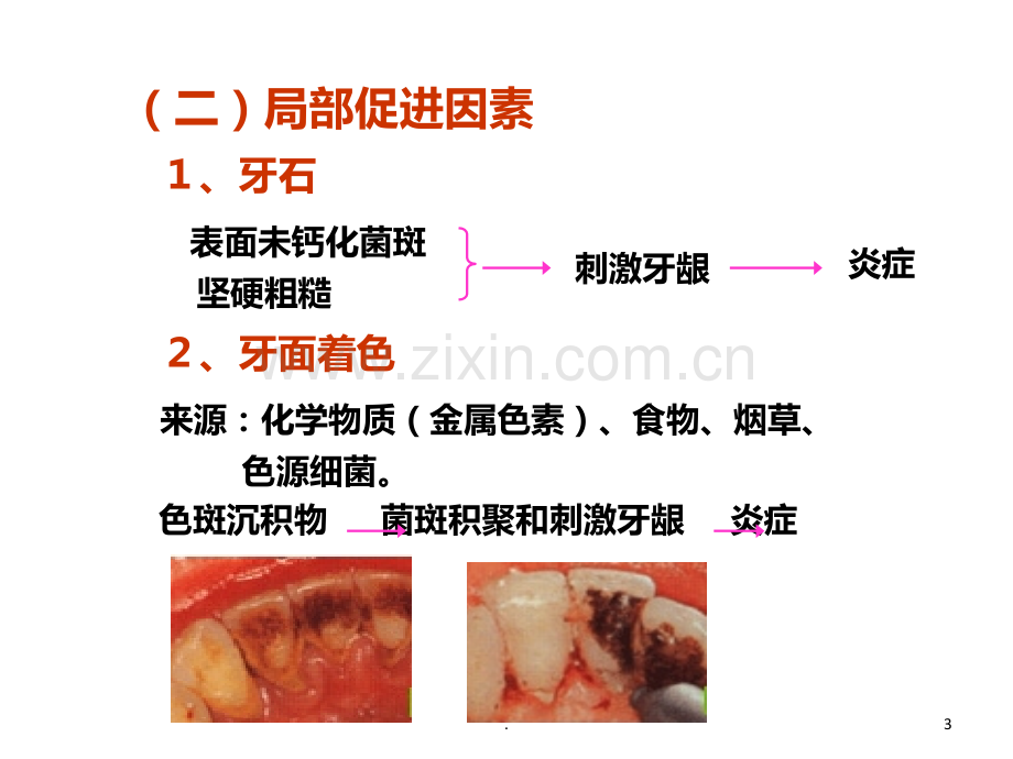 牙周炎发病机制PPT课件.ppt_第3页