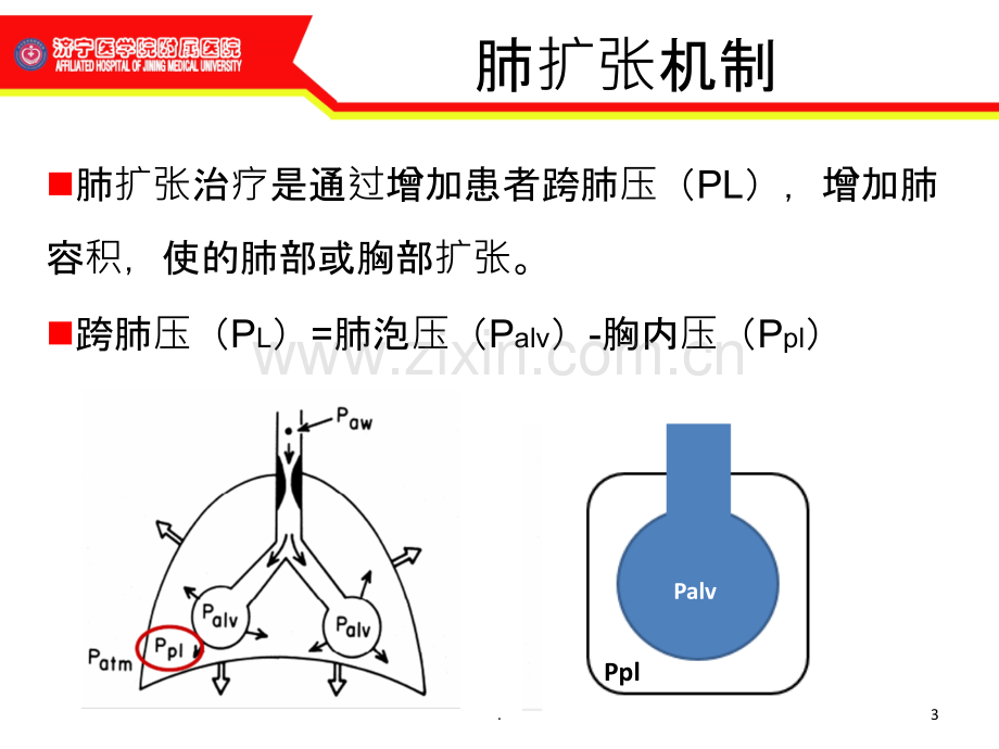 肺扩张与肺复张---副本.ppt_第3页