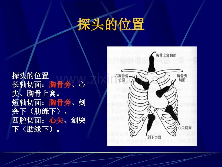 心脏彩超的判读.ppt_第3页