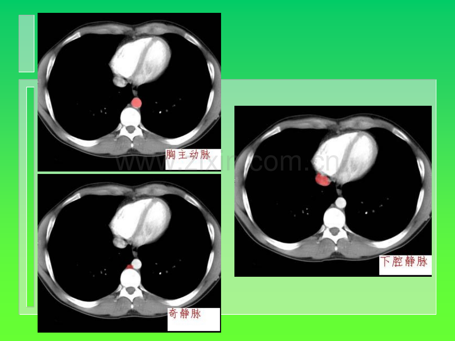 腹部C诊断很经典ppt课件.ppt_第3页