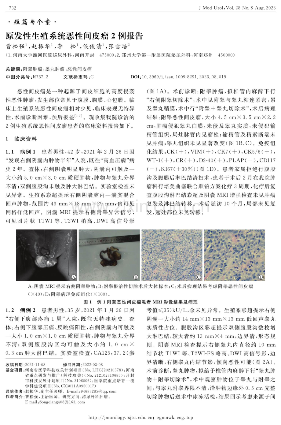 原发性生殖系统恶性间皮瘤2例报告.pdf_第1页