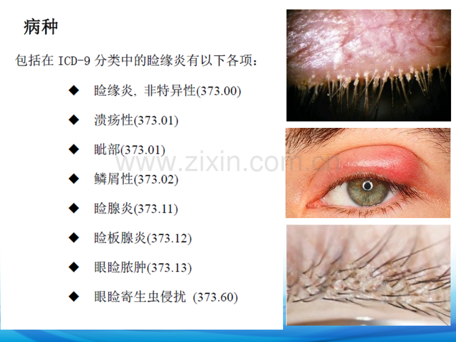 AAO-PPP-睑缘炎解析ppt课件.ppt_第2页