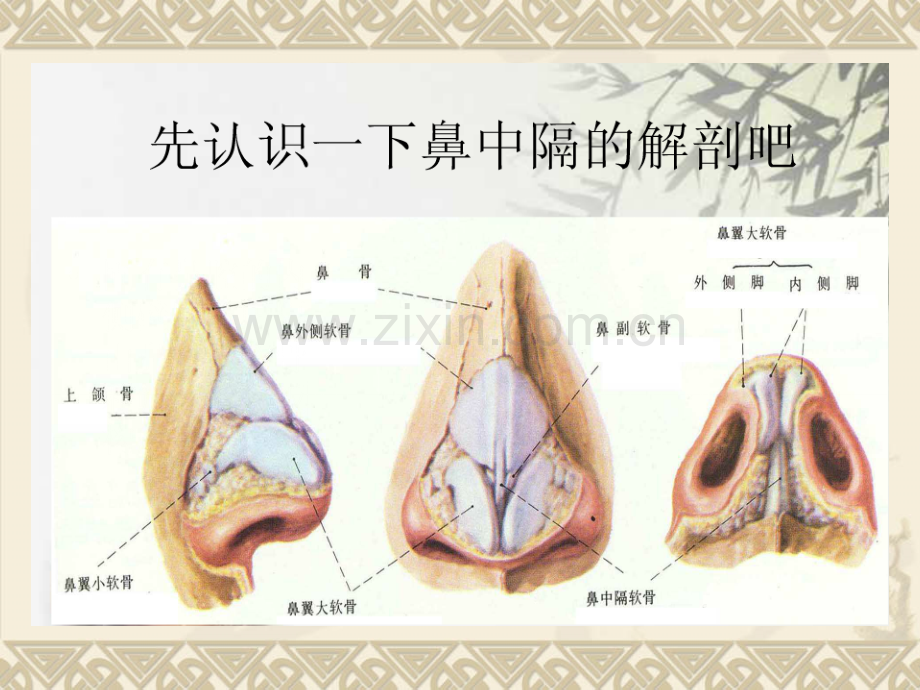 鼻中隔偏曲病人的护理.ppt_第3页