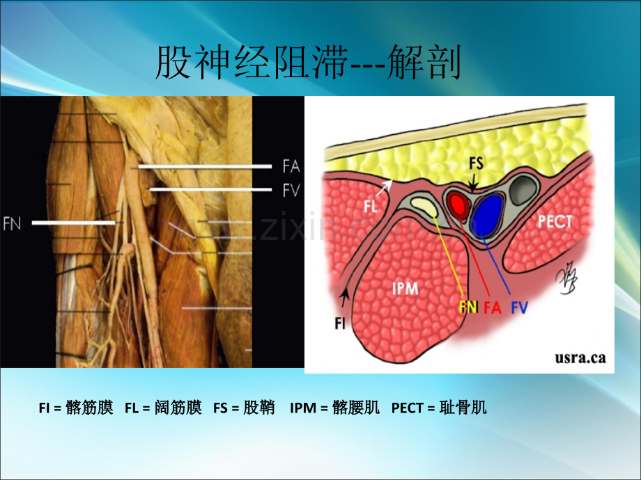 超声引导下股神经和坐骨神经支配ppt课件.ppt_第3页