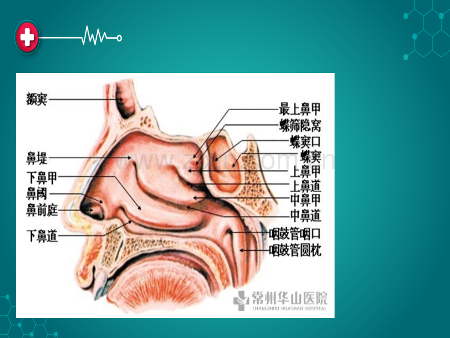 应及时手术治疗鼻息肉有一定的遗传性.ppt_第2页