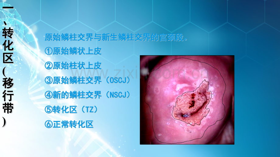 宫颈癌筛查文献汇报HPV与TCTppt课件.pptx_第2页