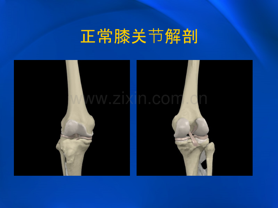 膝关节损伤常用检查法.ppt_第3页