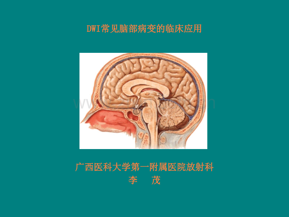 DWI常见脑部病变的临床应用(玉林)ppt课件.ppt_第1页