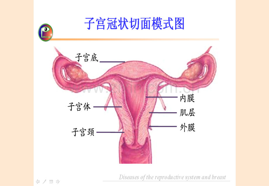 第十三章生殖系统和乳腺疾病.ppt_第3页