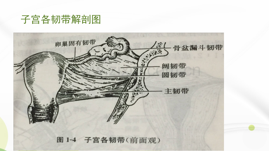 腹腔镜下全子宫切除术ppt课件.ppt_第3页