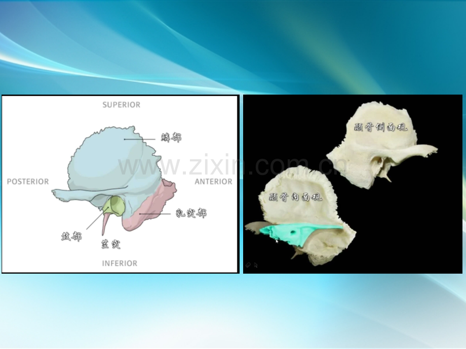 耳部基本影像解剖—周政ppt课件.pptx_第3页