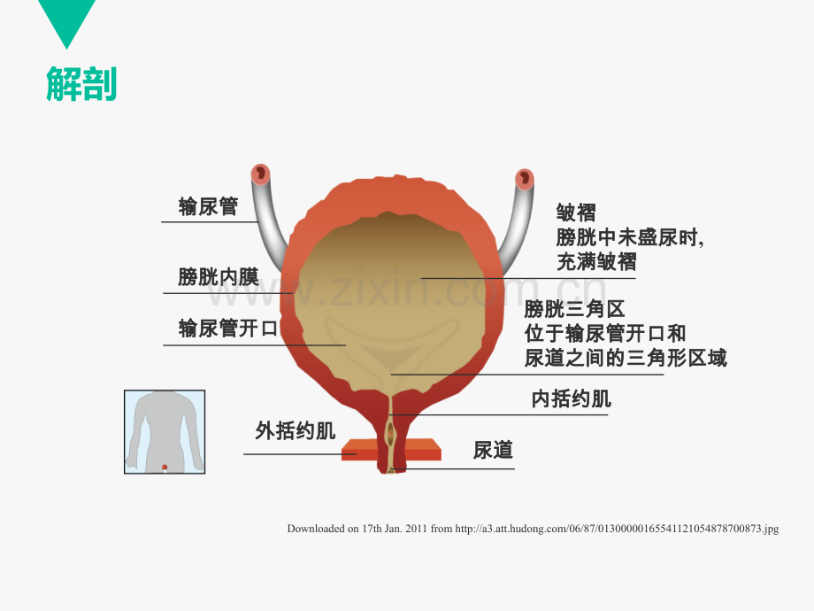 晚期膀胱癌治疗PPT课件.ppt_第3页