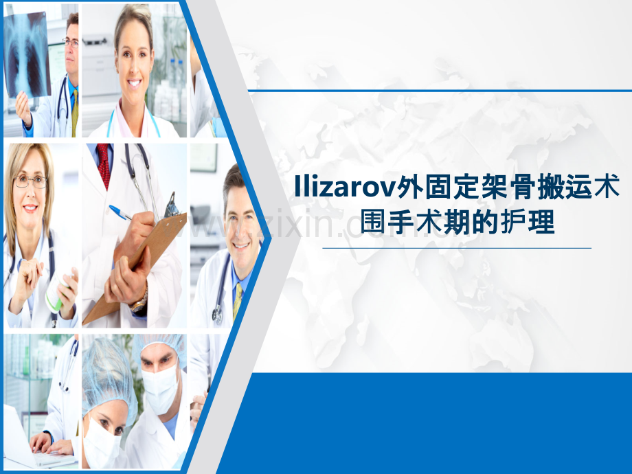 Ilizarov外固定架骨搬运术围手术期的护理-PPT课件.pptx_第1页