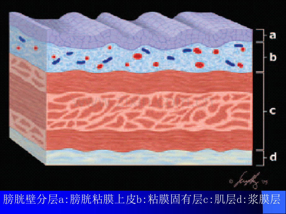 膀胱肿瘤影像诊断ppt课件.ppt_第3页