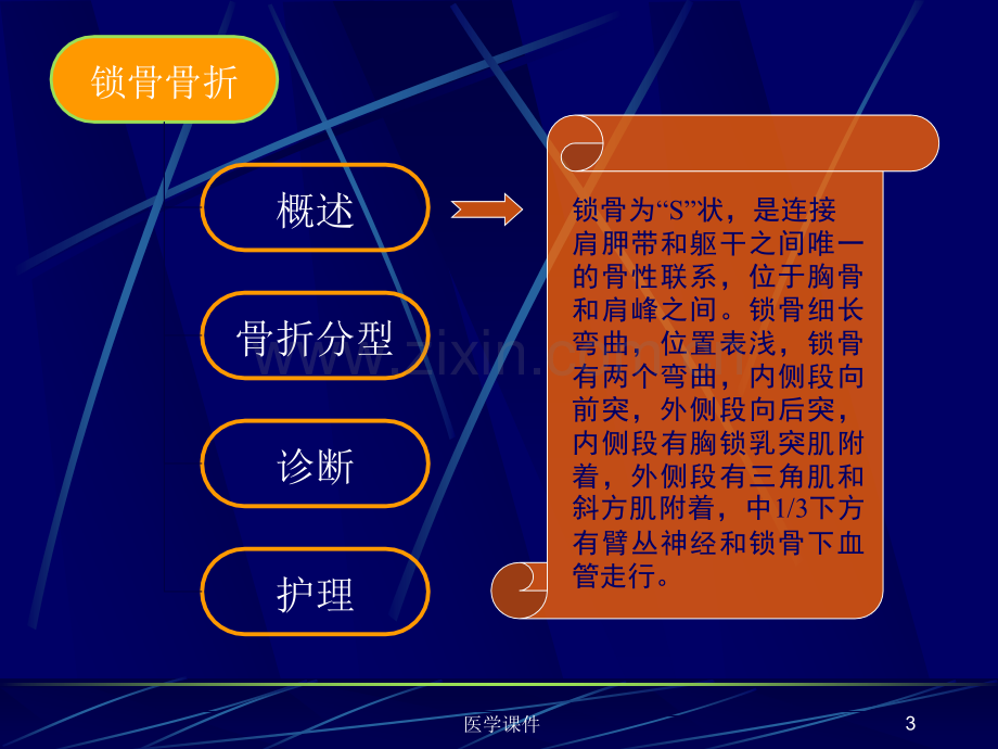 常见上肢骨折与护理PPT课件.ppt_第3页