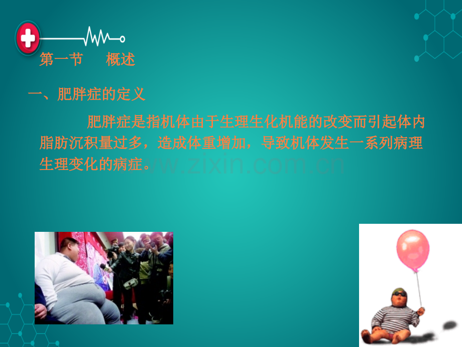 第六章-减肥功能性食品ppt课件.ppt_第3页