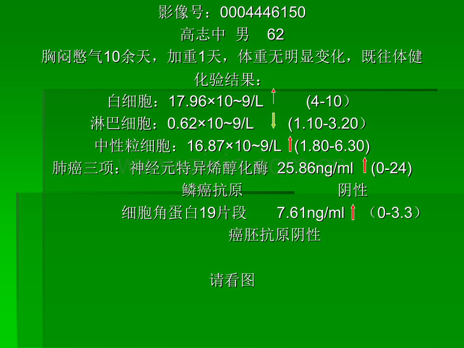 乳腺叶状肿瘤ppt课件.pptx_第2页