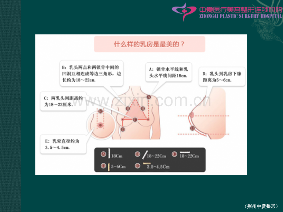 丰胸整形PPT课件ppt课件.ppt_第2页