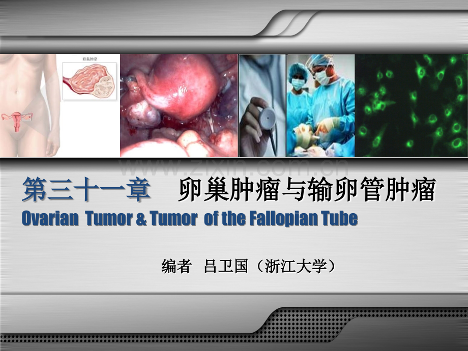 妇产科学配套课件卵巢肿瘤与输卵管肿瘤ppt课件.ppt_第3页