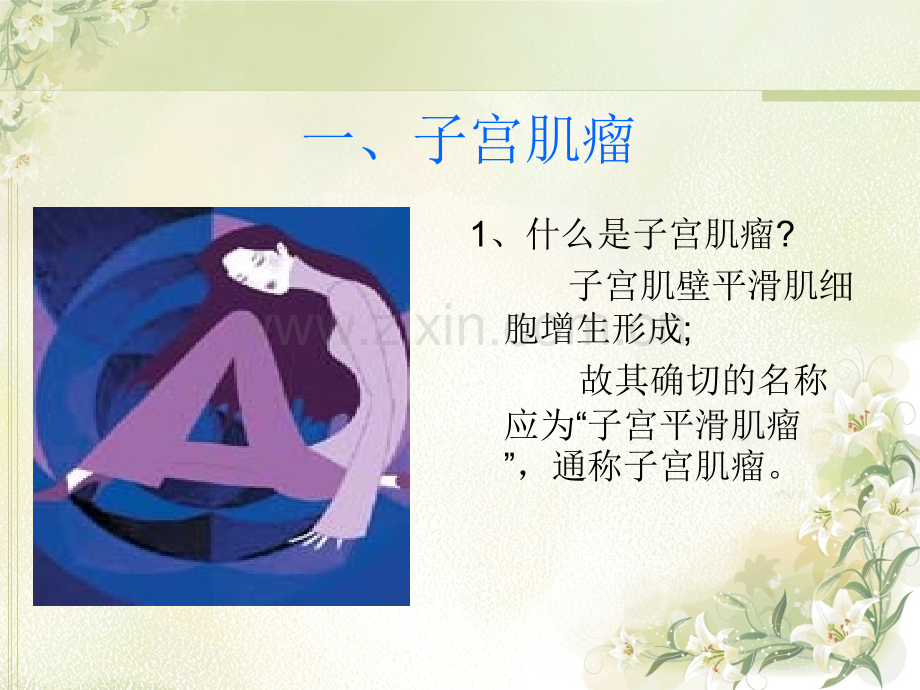 妇科肿瘤内调与防治ppt课件.ppt_第2页