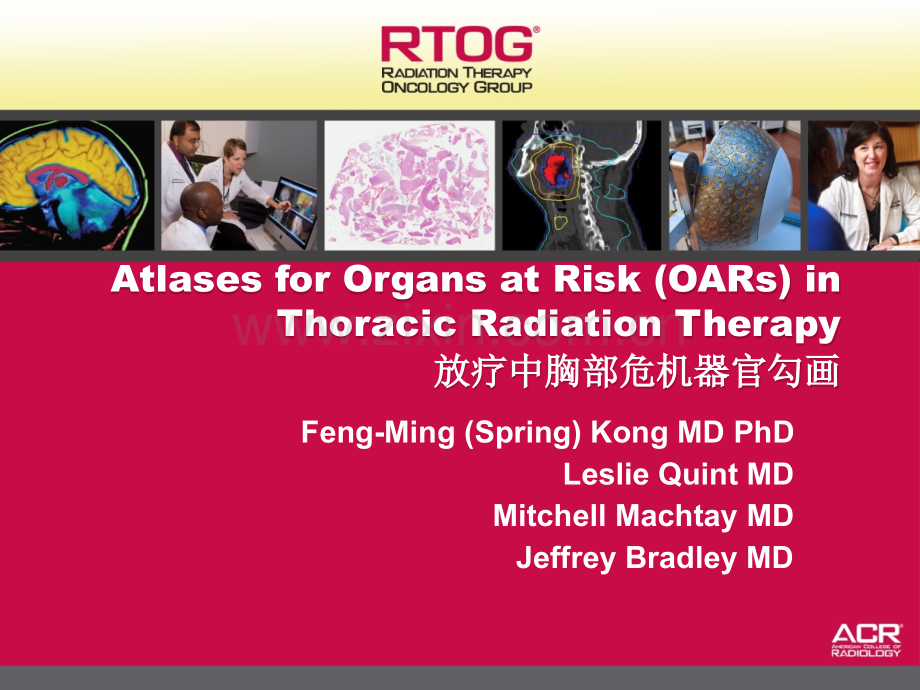 RTOG-放疗中胸部危及器官勾画-Organs-at-Risk-(OARs)-in-Thoracic.ppt_第1页