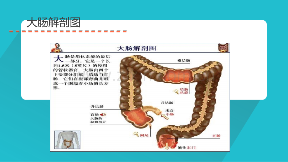 直肠癌根治术术后护理.ppt_第3页