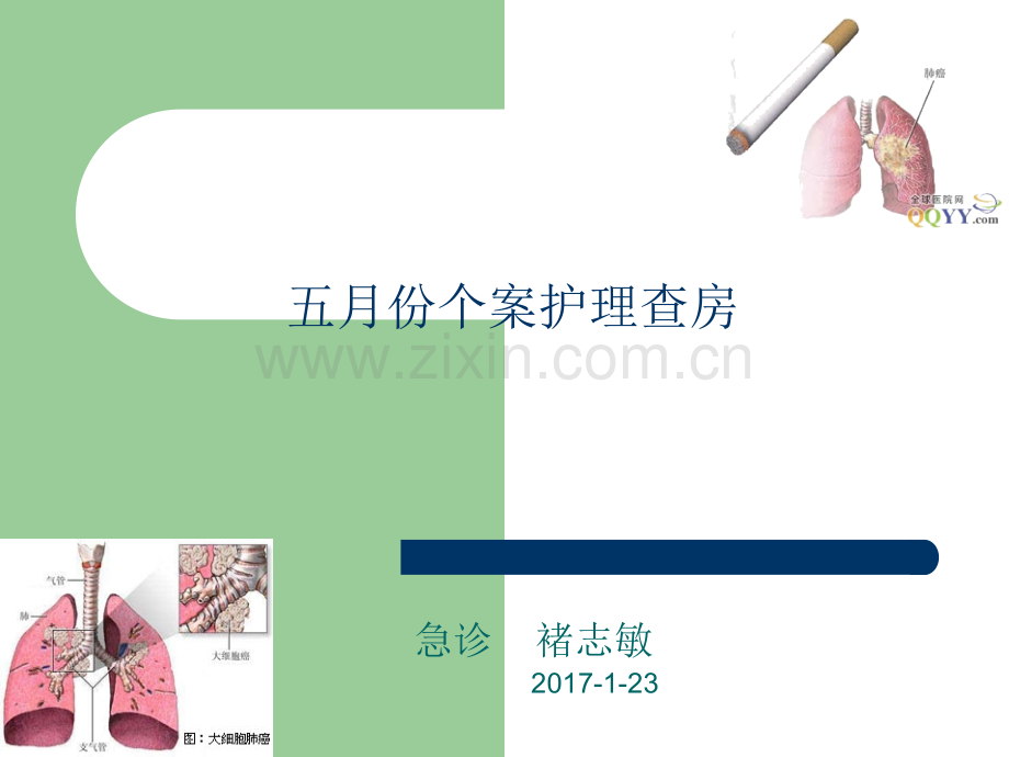 肺癌脑转移患者护理查房PPT.ppt_第1页