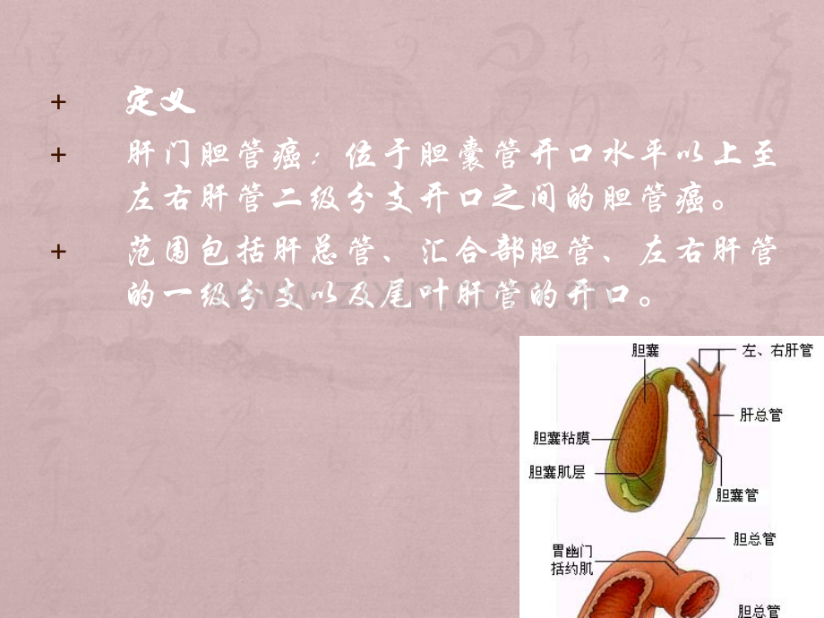 医学影像-肝门胆管癌的影像诊断与病理联系.ppt_第3页