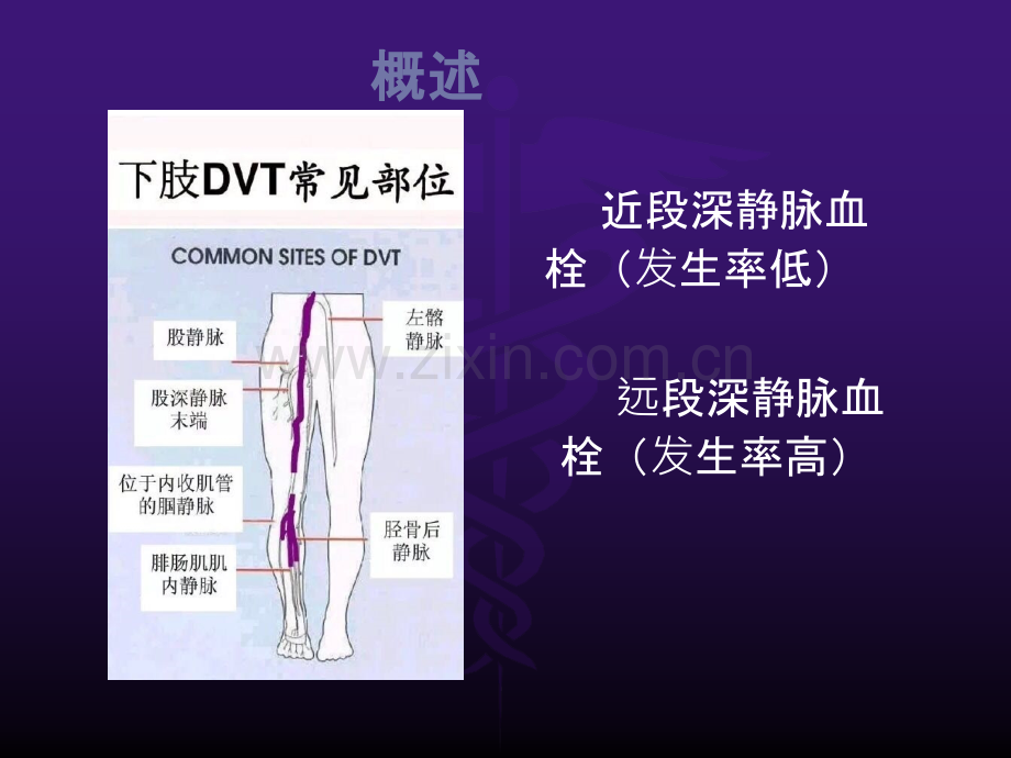 下肢静脉血栓预防ppt课件.pptx_第3页