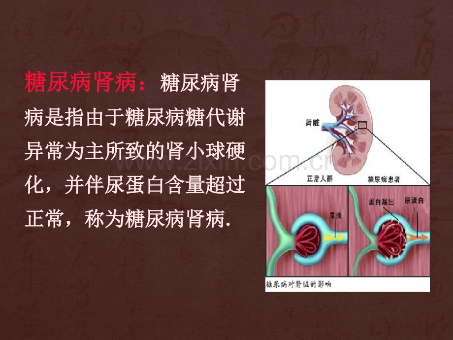 刘廷奎医生解读：糖尿病肾病病人的护理ppt课件.pptx_第2页