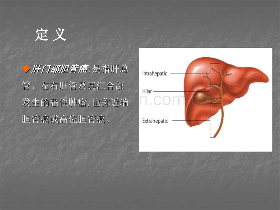 肝门部胆管癌的分型与手术策略ppt课件.ppt_第3页