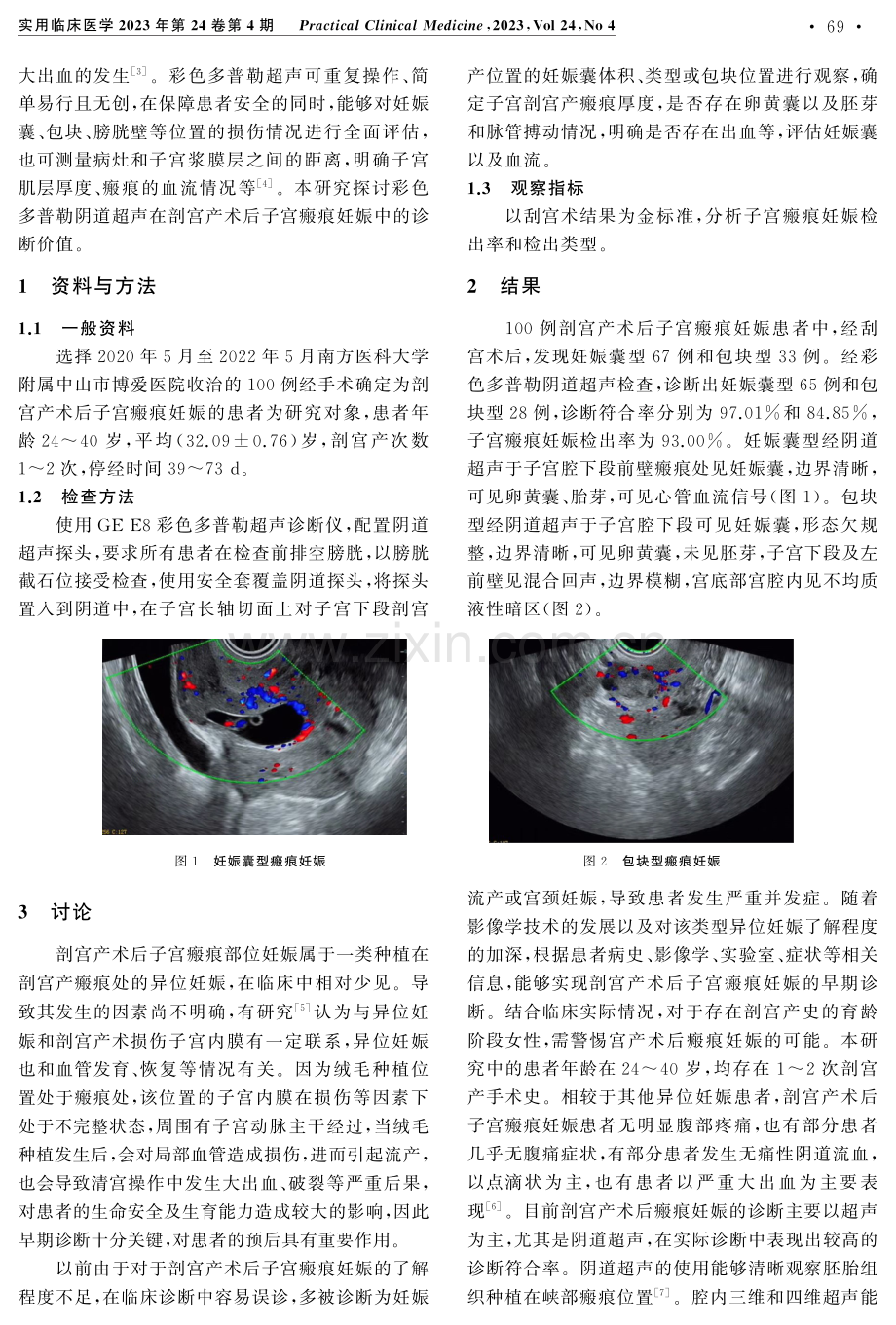 彩色多普勒阴道超声诊断剖宫产术后子宫瘢痕部位妊娠的临床价值.pdf_第2页