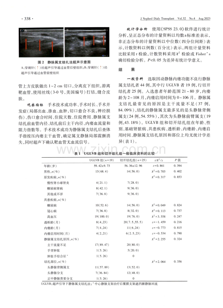 超声引导下静脉属支结扎治疗动静脉内瘘功能不良的疗效.pdf_第3页