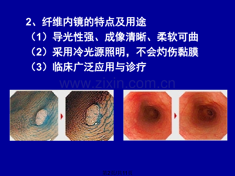 七纤维内镜检查.pptx_第2页