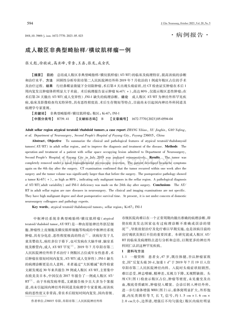 成人鞍区非典型畸胎样_横纹肌样瘤一例.pdf_第1页