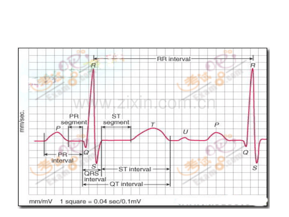 常见病心电图表现.pptx_第2页