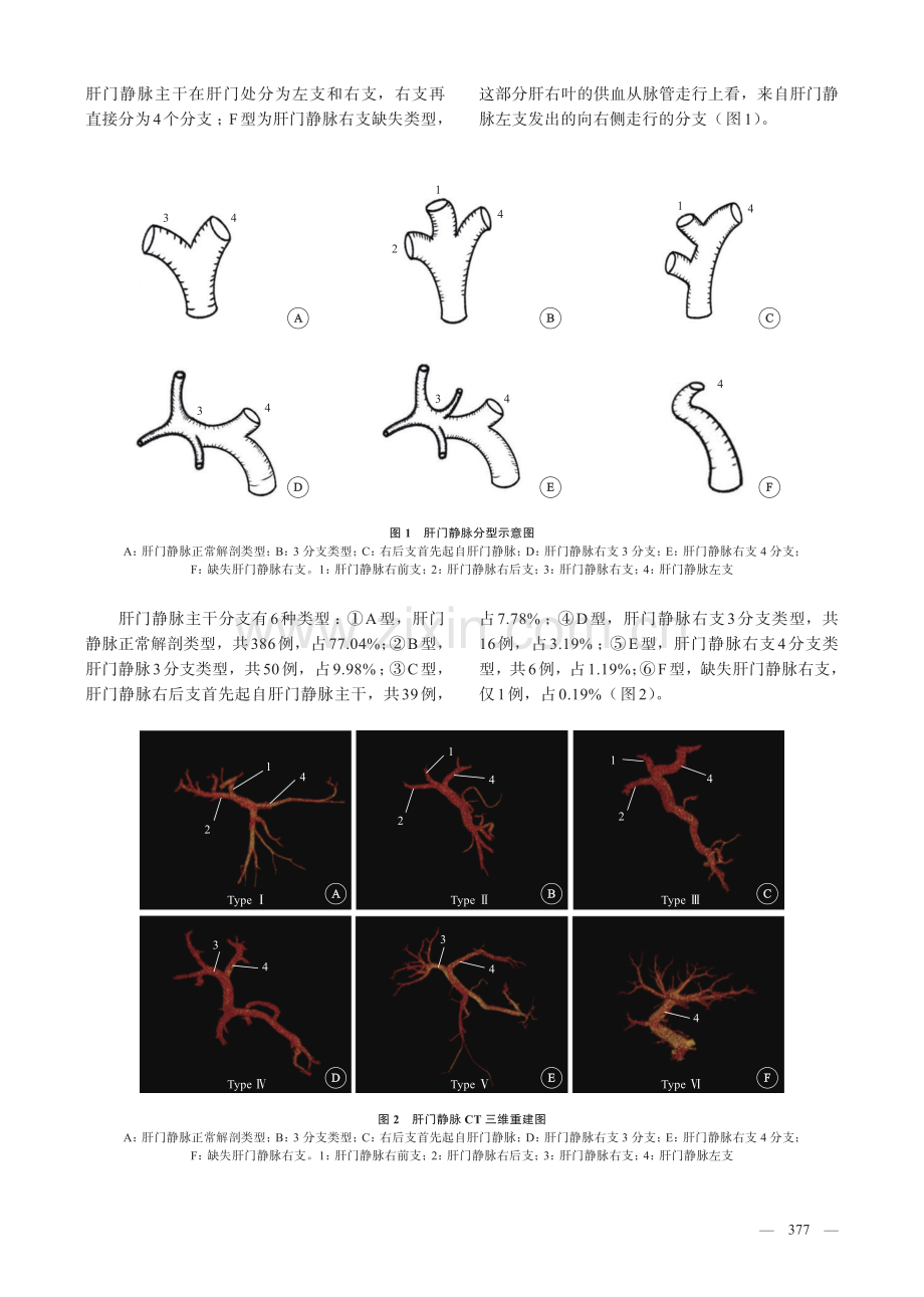 成年国人肝门静脉右支的三维CT解剖.pdf_第3页